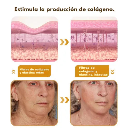 Crema Lifting De Veneno De Abeja Botox
