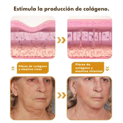 Crema Lifting De Veneno De Abeja Botox