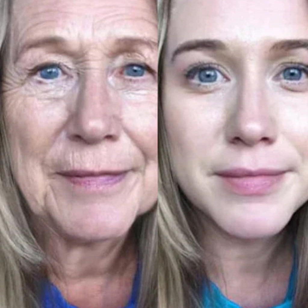 Crema Lifting De Veneno De Abeja Botox