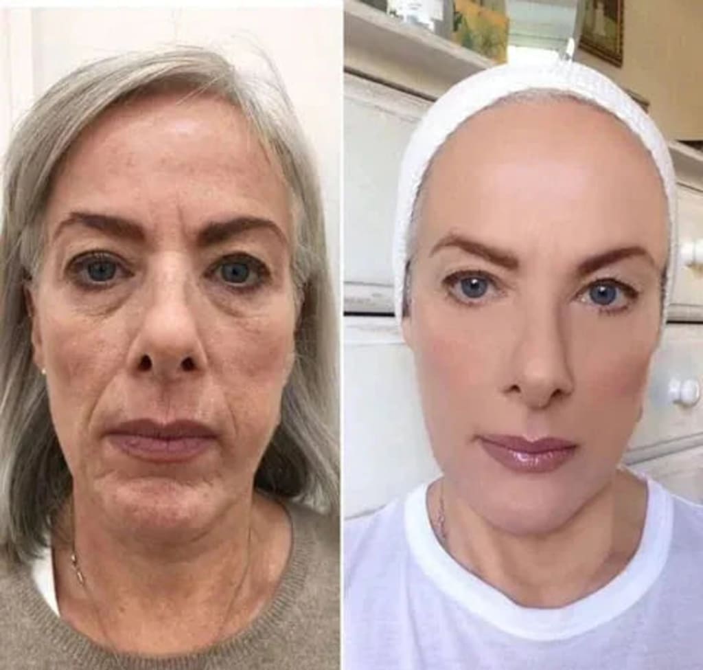 Crema Lifting De Veneno De Abeja Botox