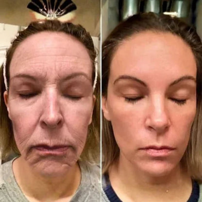 Crema Lifting De Veneno De Abeja Botox